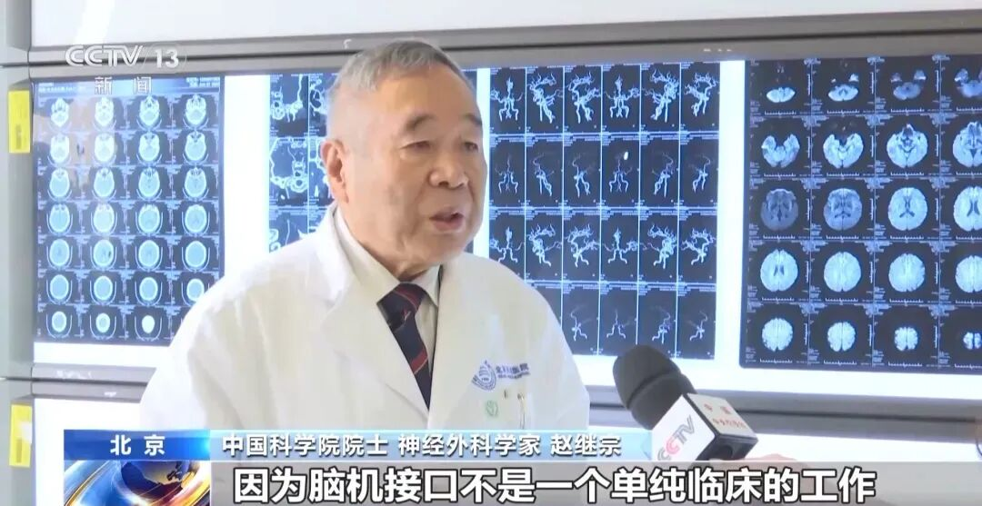 成果转化