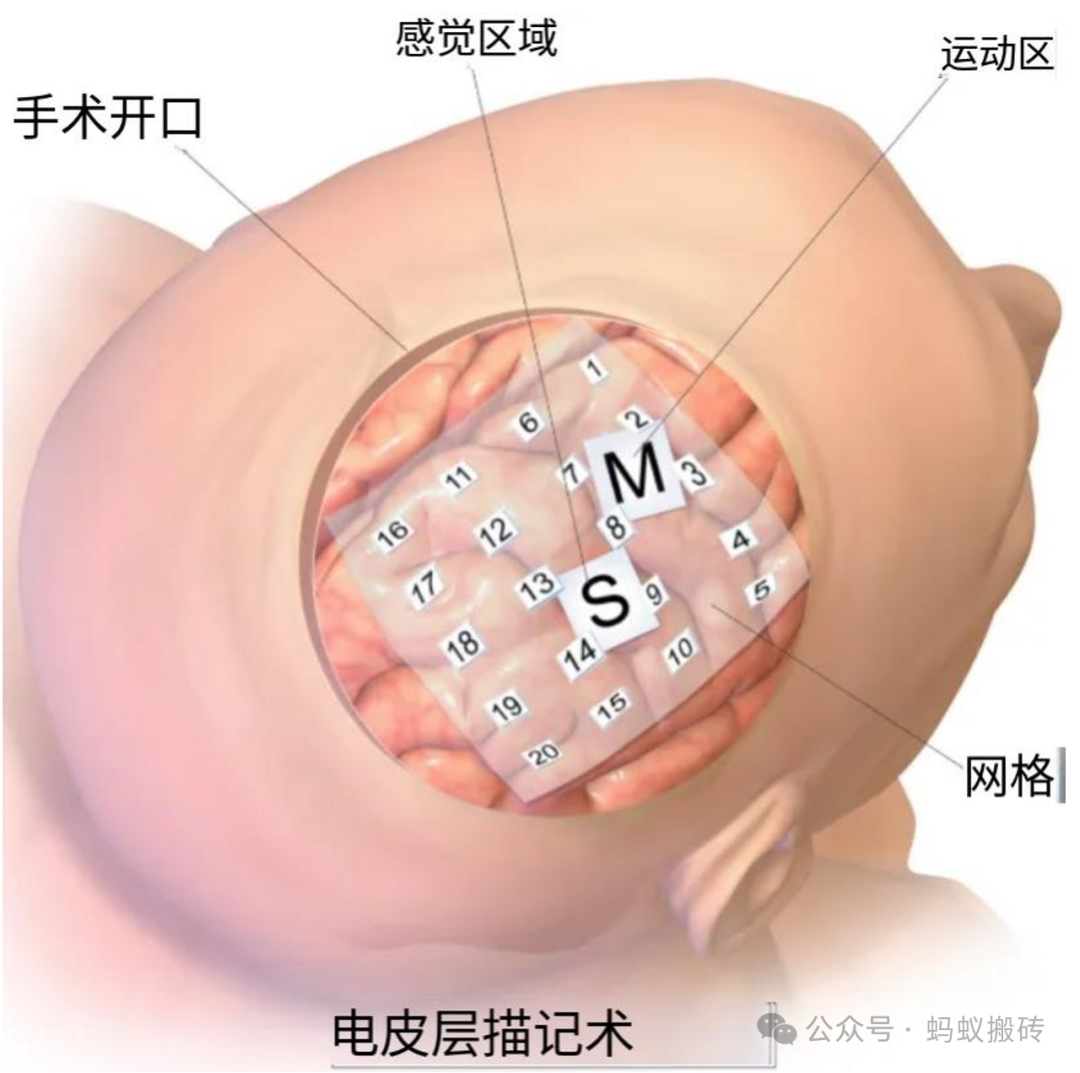 内容图片